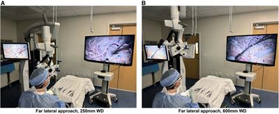 Computational image analysis of distortion, sharpness, and depth of field in a next-generation hybrid exoscopic and microsurgical operative platform